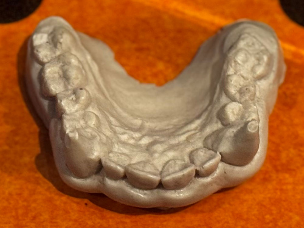 Ripley's Michael Jackson's Thriller Fangs